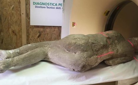 Cuerpo de Pompeya sometido al escáner Cuerpo de Pompeya sometido al escáner